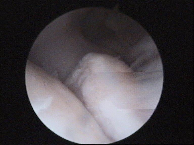 Praktijkcongres Osteochondrose